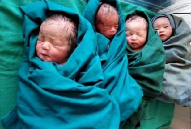Quadruplets babies among quintuplets.